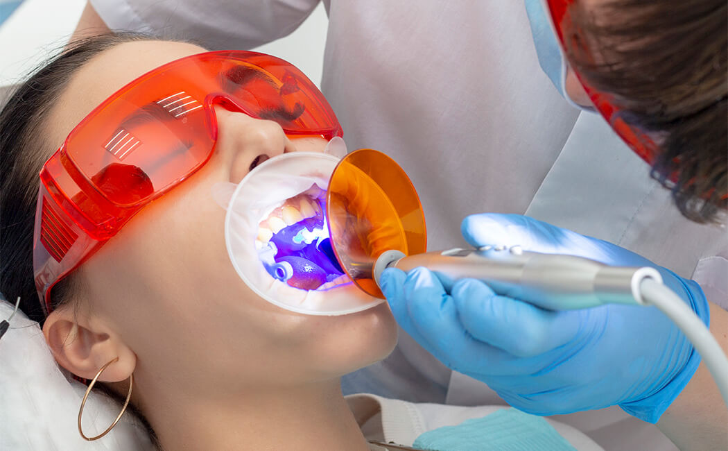 teeth whitening